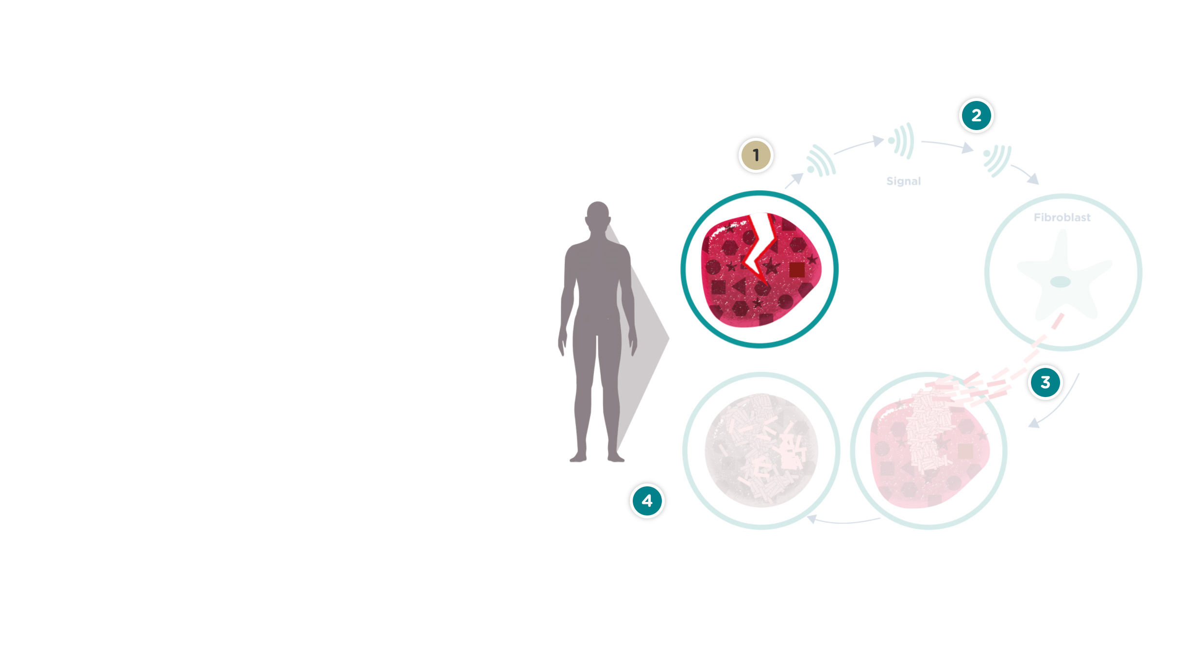 Läkningscykel vid sklerodermi