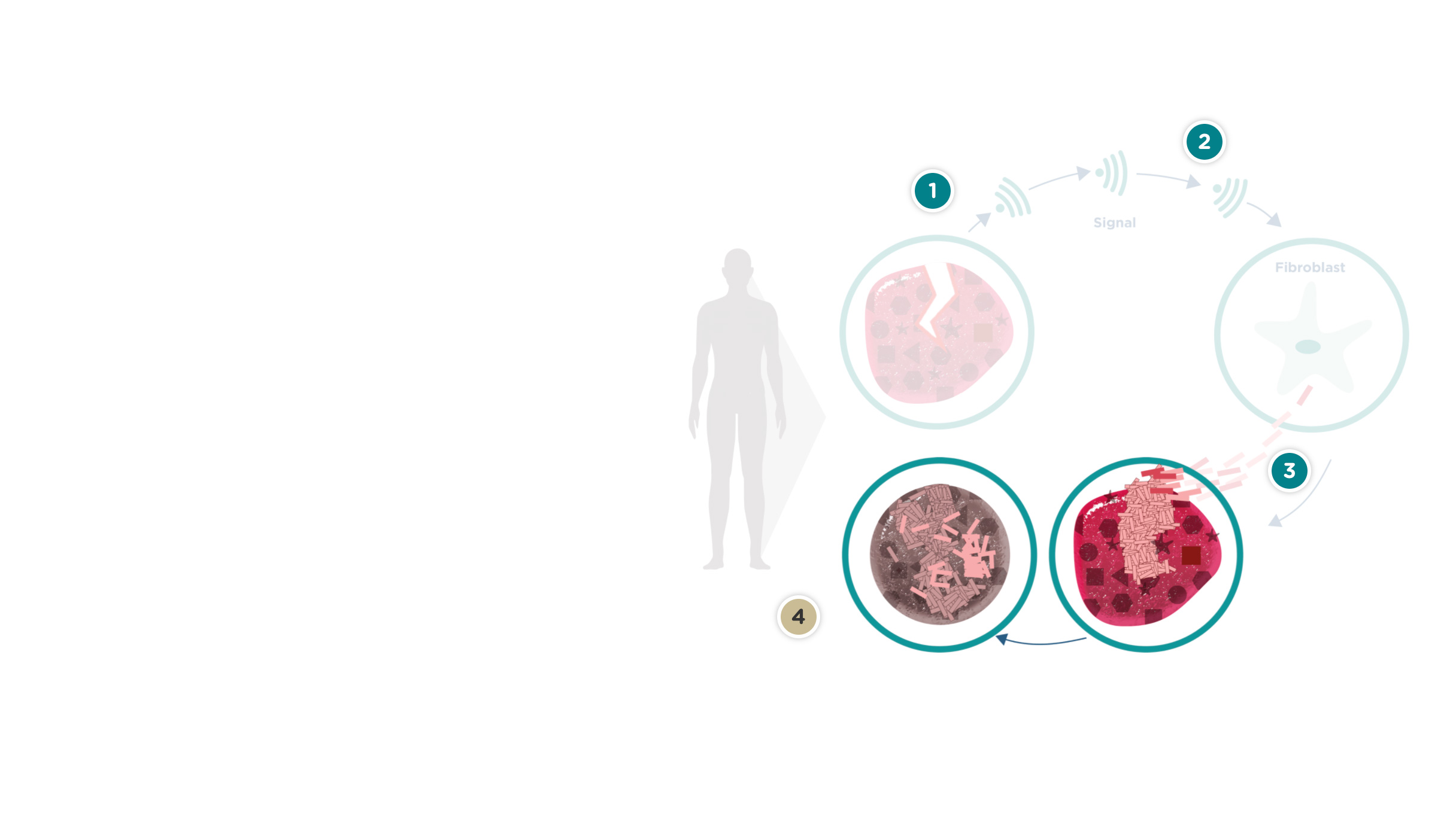 Läkningscykel vid sklerodermi
