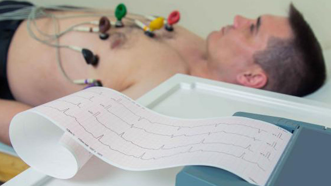 Vid ett EKG