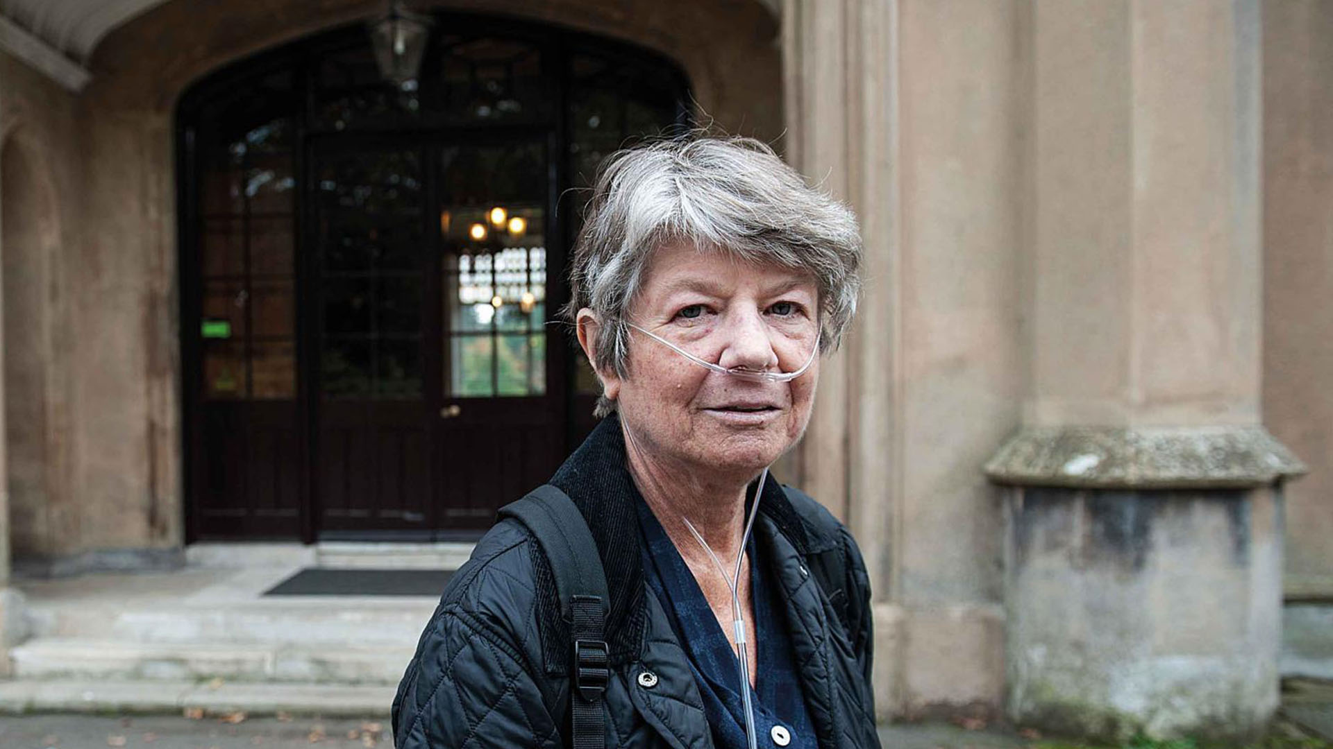 Interstitiell lungsjukdom