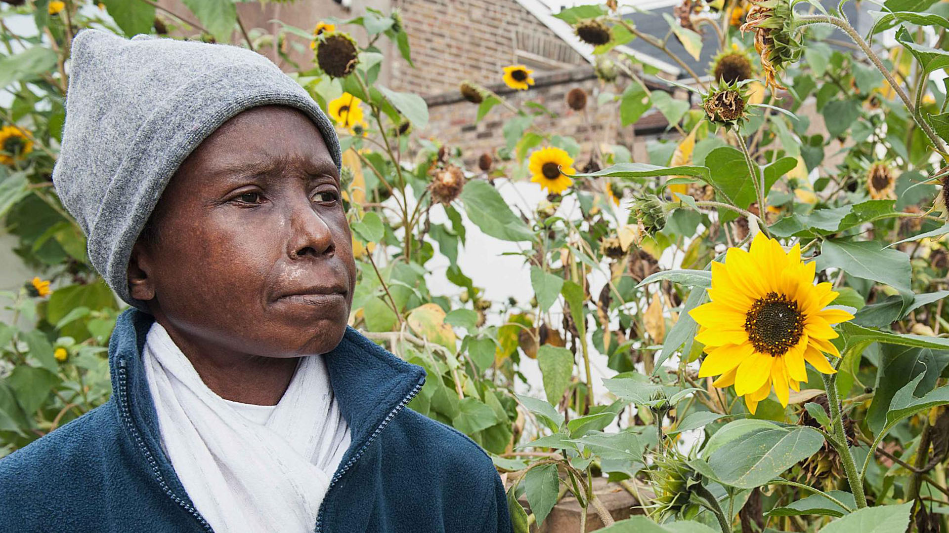 Systemisk skleros tester