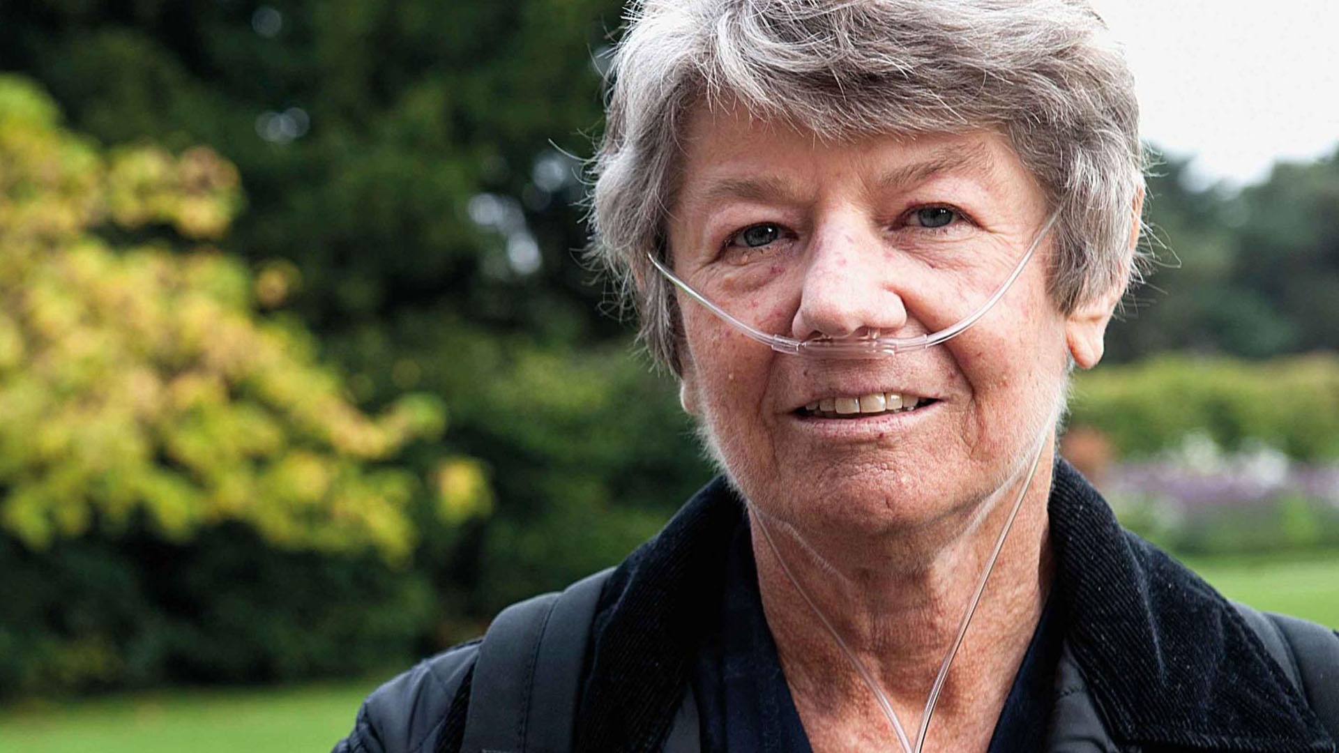 Systemisk skleros och lungorna