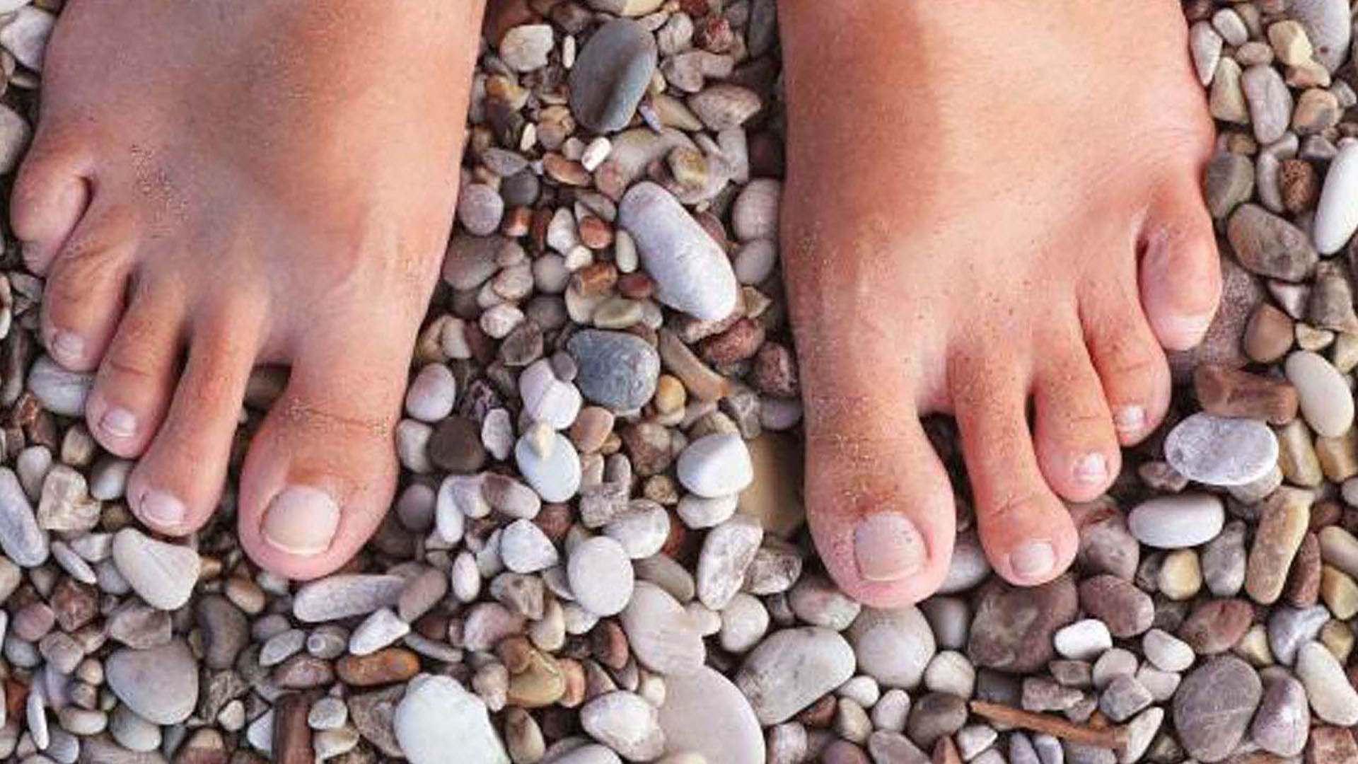 Raynaud’s phenomenon