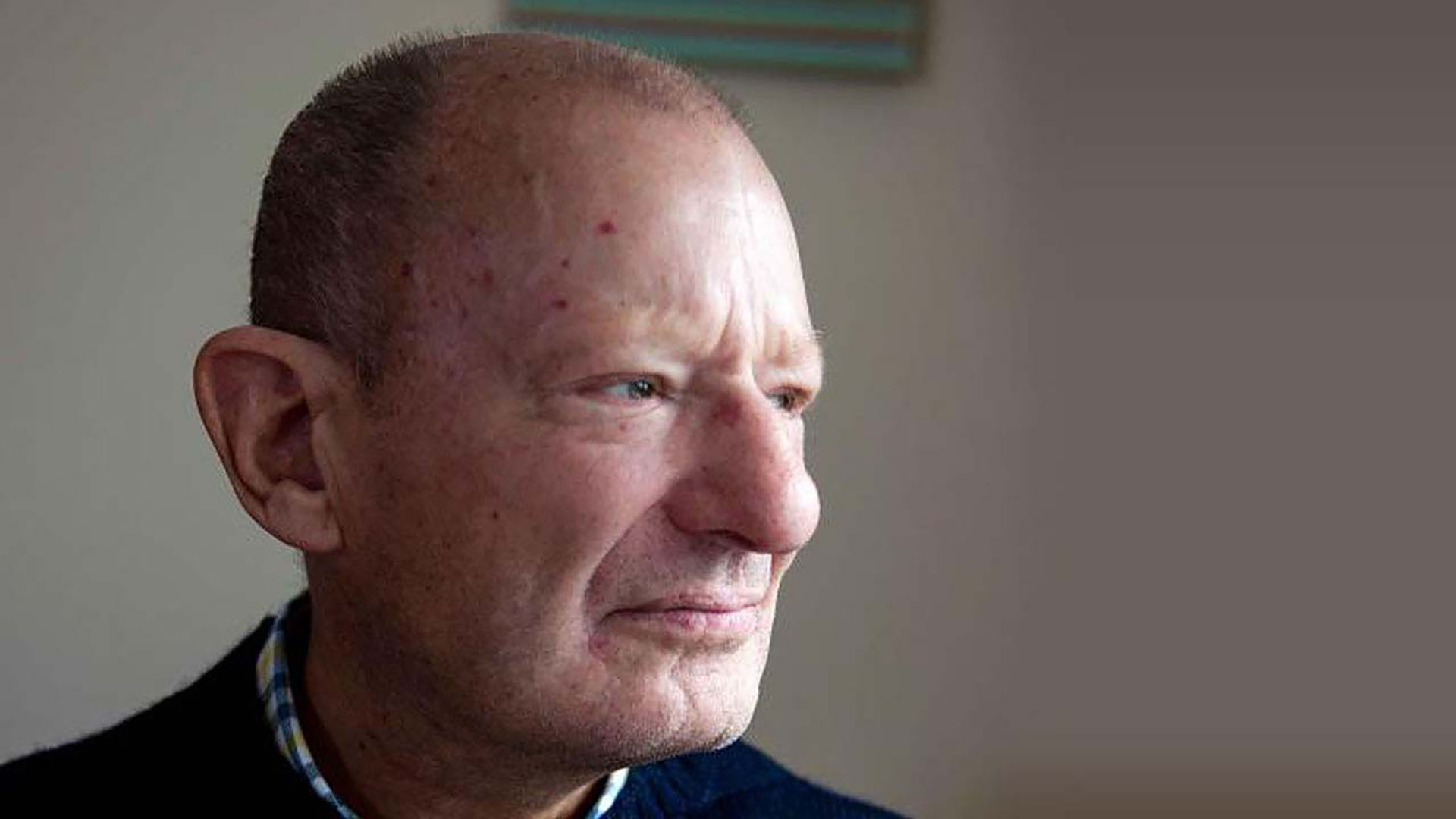 Röda prickar (telangiektasi)