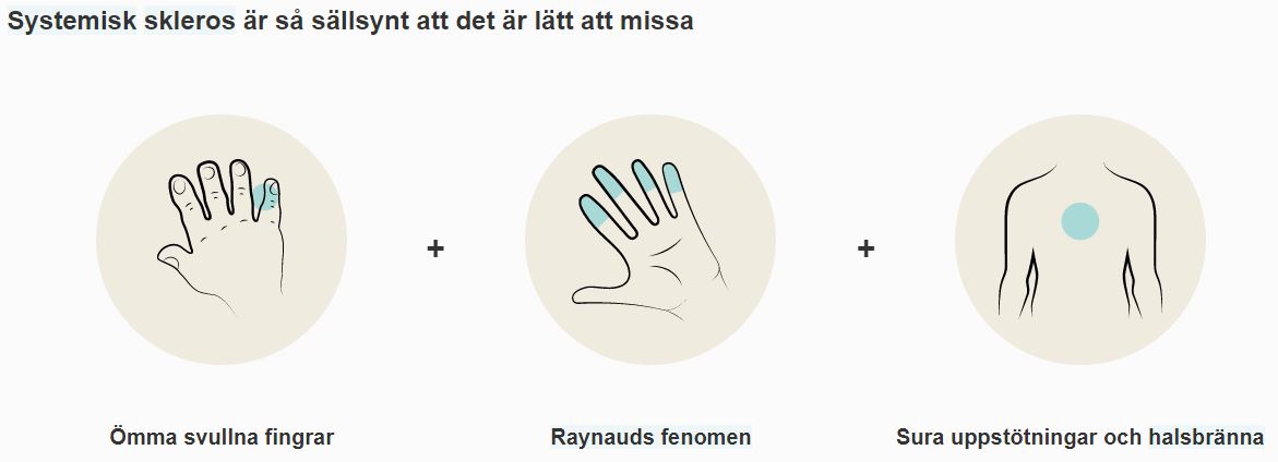Systemisk skleros är så sällsynt att det är lätt att missa.