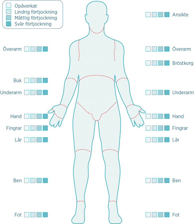 Att förstå dina resultat