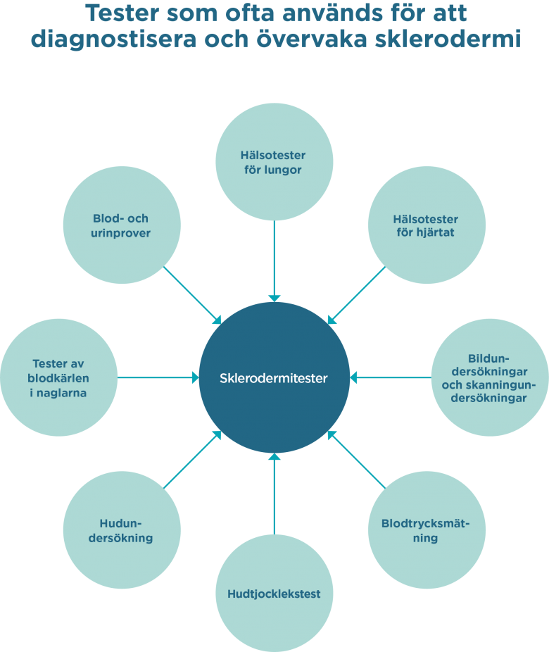 se_scleroderma_tests_diagram se_scleroderma_tests_diagram